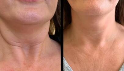 Best Aesthetic Clinic in dubai