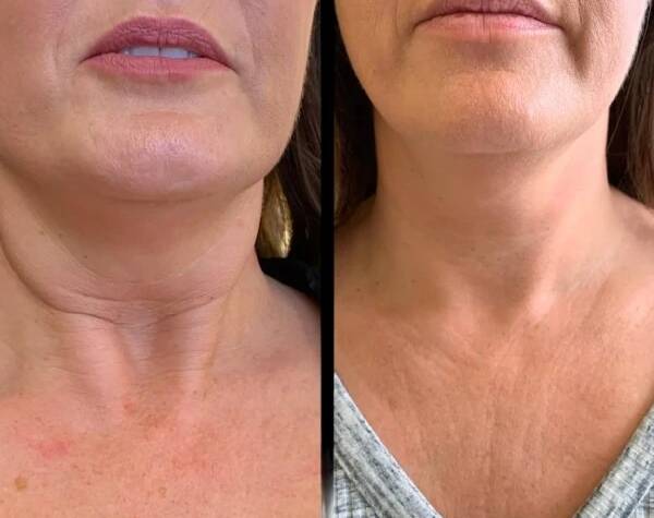 Best Aesthetic Clinic in dubai