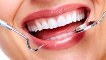 Dental Tooth Filling Dubai