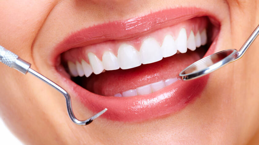 Dental Tooth Filling Dubai
