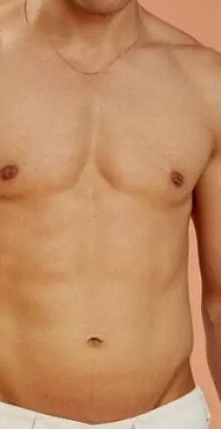 شفط الدهون في جدة