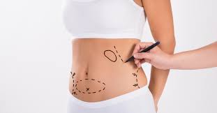 vaser liposuction in dubai